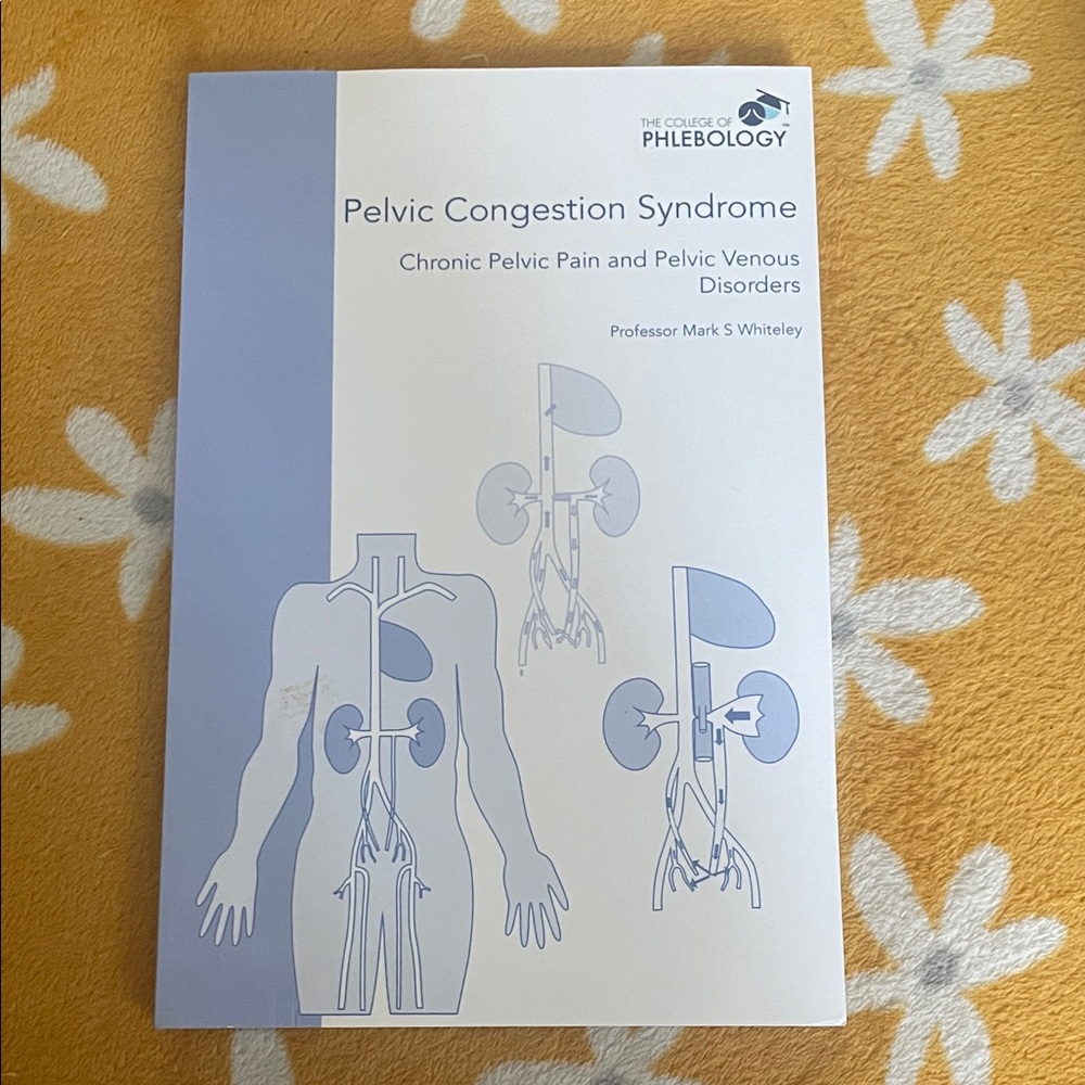 Pelvic Congestion Syndrome Book - Light Blue & White